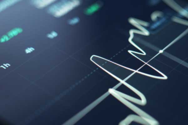 通胀担忧挥之不去 美债收益率持续攀升